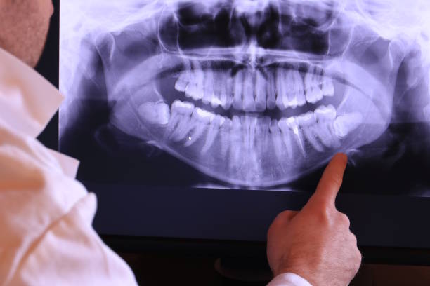 Best Emergency Treatment for Toothache in Cuthbert, GA